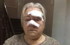 В Твери пенсионерку с травмами после падения на нее остановки отказались принять в больнице