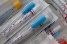 За сутки коронавирус подтвержден у 236 жителей Ставрополья