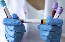 За сутки коронавирус подтвержден у 243 жителей Ставропольского края