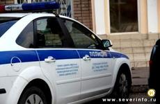 Житель Череповца укусил за руку сотрудника полиции