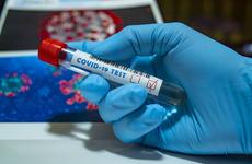 На Дону число инфицированных COVID-19 с начала пандемии превысило 15 тысяч