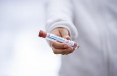 В Ростовской области COVID-19 за последние сутки подтвердился у 388 человек