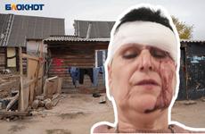 В Волгограде за сделанное замечание цыганским детям женщине пробили голову кирпичом