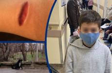 В Волгодонске следствие проверит информацию о нападении собаки на школьника