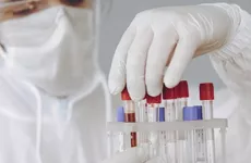 В Петербурге повысилось число выздоровевших от COVID-19