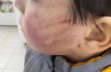 В Георгиевске лишилась работы ударившая ребенка воспитательница детского сада