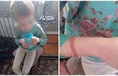 В Ростовской области арестованы супруги, которые истязали свою 7-летнюю дочь