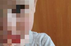 В Ставрополе в частном детском саду годовалый малыш получил травмы