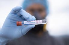 Еще 486 жителей Дона заразились COVID-19