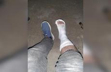 Мужчина сломал ногу, угодив в яму, оставленную дорожниками в Волжском