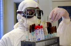 Первый случай заболевания сибирской язвой зафиксировали недалеко от Ростовской области