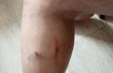 Бродячие собаки искусали волгоградку на остановке